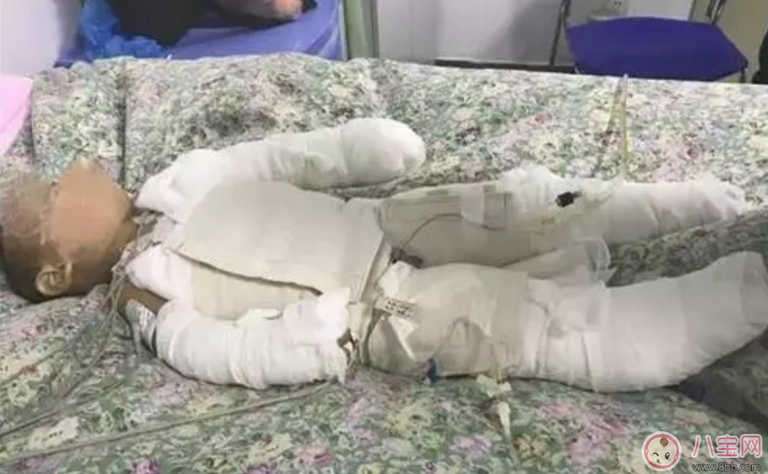 父母讓8歲姐給1歲弟洗澡 “洗”成一場大禍