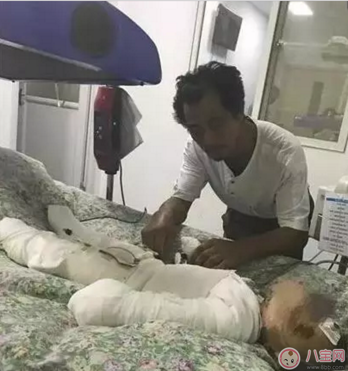 父母讓8歲姐給1歲弟洗澡 “洗”成一場大禍